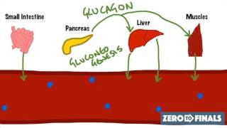 Diabetic Ketoacidosis Diabetes Type I Management Summary [upl. by Eyanaj]