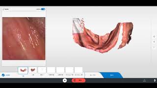 Scan fully edentulous with Primescan [upl. by Combe]