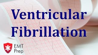 Ventricular Fibrillation ECG  EMTprepcom [upl. by Enutrof]