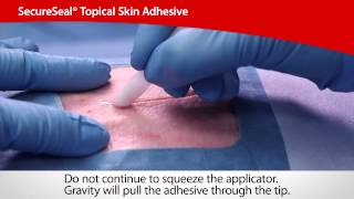 SecureSeal® Topical Skin Adhesive  Cardinal Health [upl. by Eenhat]