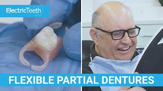 Flexible dentures amp false teeth explained [upl. by Etnaihc]