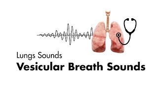 Vesicular Breath Sounds  Normal Lung Sounds  MEDZCOOL [upl. by Ellertal]