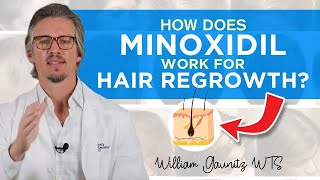 Minoxidil How Does Minoxidil Work For Hair Regrowth Results  Trichologist William Gaunitz [upl. by Brynne929]