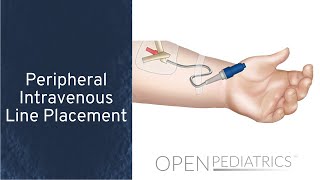 Peripheral Intravenous Line Placement by B Johnson L DelSignore  OPENPediatrics [upl. by Acireh]