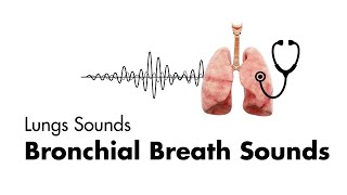 Bronchial Breath Sounds  Lung Sounds  Medzcool [upl. by Eehc877]