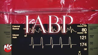 Intra Aortic Balloon Pump IABP  Timing and Mechanism [upl. by Gianna934]