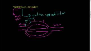 46Hyperemia vs Congestion [upl. by Carver]