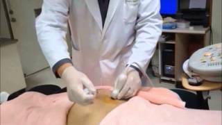 UltrasoundGuided Sacroiliac Joint Injection Technique [upl. by Parthenia]