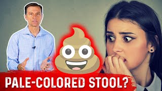 What Does PaleColored Poop Mean – DrBerg [upl. by Yendic]