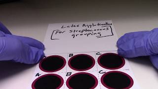 Latex Agglutination FOR Streptococcus Grouping [upl. by Arihs]