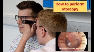 How to perform Otoscopy Ear Exam [upl. by Zelig834]