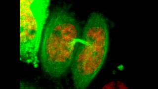 Mitosis in 2D  HeLa Cell Undergoes Mitosis [upl. by Durno611]