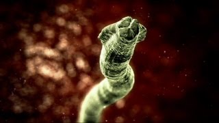 Deadly Roundworm  Monsters Inside Me Ep6 [upl. by Bullock]