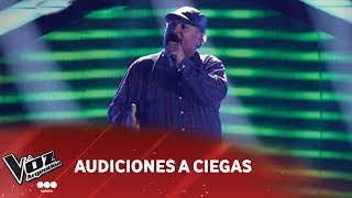 Pablo Carrasco  quotStill Loving youquot  Scorpions  Audiciones a Ciegas  La Voz Argentina 2018 [upl. by Acinahs]