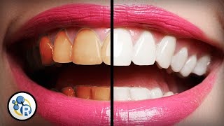 Whats The Best Way To Whiten Teeth [upl. by Yngiram]