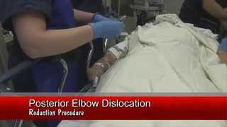 Elbow Dislocation Reduction [upl. by Eblehs]