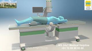 Extracorporeal Shock Wave Lithotripsy ESWL – CIMS Hospital [upl. by Shirl]