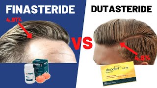 Dutasteride VS Finasteride  Which Is BETTER For Your Hair Growth [upl. by Arodaeht]