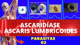 ASCARIDÍASE  ASCARIS LUMBRICOIDES LOMBRIGA  PARASITOLOGIA  INFECTOLOGIA [upl. by Israeli940]