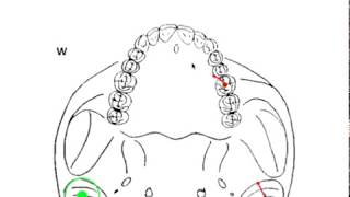 DYNAMIC OCCLUSION  Working vs Nonworking Movement amp Occlusal Grid [upl. by Savitt]