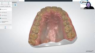 Webinar 3Shape Aligner Studio with Ortho Analyzer with Matthew Davis [upl. by Maher]