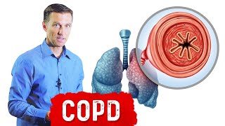 Chronic Obstructive Pulmonary Disease COPD [upl. by Atinra]