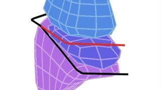 Lung Lobes amp Fissures  Simple 3D Anatomy [upl. by Elleuqram]