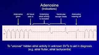 Antiarrhythmics Lesson 6  Digoxin Adenosine Atropine Isoproterenol and Ivabradine [upl. by Maida12]