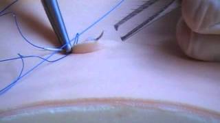 Subcuticular Suture Technique [upl. by Elohcin866]