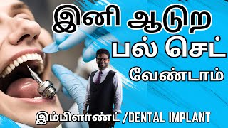 Fixed பல் கட்டும் முறைஇம்ப்ளாண்ட் சிகிச்சை𝐃𝐞𝐧𝐭𝐚𝐥 𝐈𝐦𝐩𝐥𝐚𝐧𝐭 𝐓𝐫𝐞𝐚𝐭𝐦𝐞𝐧𝐭 𝐢𝐧 𝐓𝐚𝐦𝐢𝐥𝐏𝐚𝐥 𝐤𝐚𝐭𝐭𝐮𝐯𝐚𝐭𝐡𝐮 𝐞𝐩𝐩𝐚𝐝𝐢 [upl. by Annaert503]