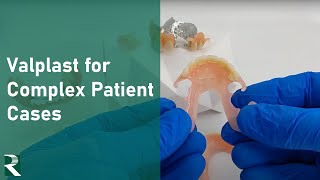 Valplast Dentures for Complex Patient Cases [upl. by Alpert]