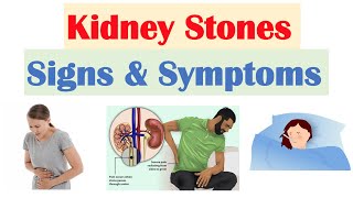 PostObstructive Diuresis  Diagnosis Pathophysiology Fluid Repletion Management Complications [upl. by Ahsema914]