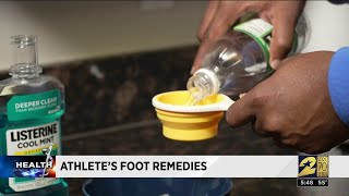 How to help knock out Athletes Foot [upl. by Hooge]