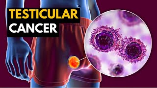 Testicular Cancer Causes Signs and Symptoms Diagnosis and Treatment [upl. by Sundstrom]