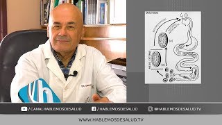 PARASITOSIS INTESTINAL  DR JORGE GAUNA [upl. by Avrit]