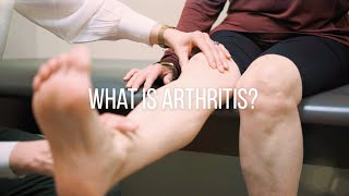 Knee Arthritis Causes Symptoms and Treatment [upl. by Saibot]