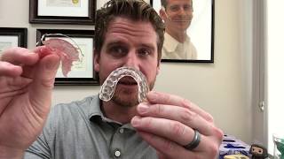 What Is The Best Orthodontic Retainer [upl. by Assiralc]