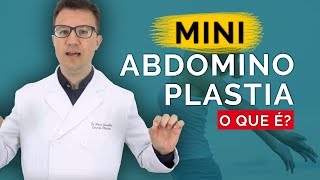 MINI ABDOMINOPLASTIA O Que É  Dr Flávio Quinalha [upl. by Atiuqcaj]