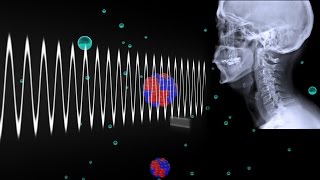 How Do Xrays Work [upl. by Blasien684]