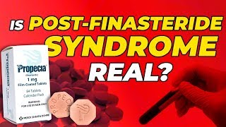 Is PostFinasteride Syndrome Real  Diagnosing And Reversing It [upl. by Reffineg]