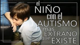 El NIÑO con el AUTISMO más EXTRAÑO que EXISTE [upl. by Viola]