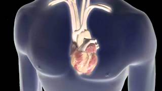 Atrial Fibrillation AFib Animation [upl. by Ryder515]