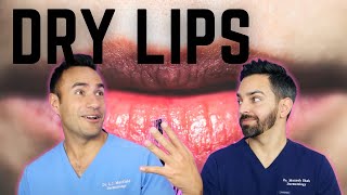 DRY CHAPPED LIPS DERMATOLOGY TIPS [upl. by Mor]