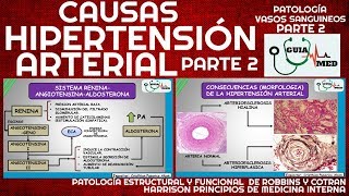 SINTOMAS DE HIPERTENSIÓN ARTERIAL FISIOPATOLOGÍA PARTE 2  GuiaMed [upl. by Slater612]