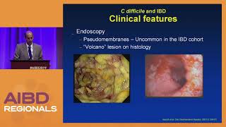 My Treatment Approach to Clostridioides difficile Infection [upl. by Hinckley]