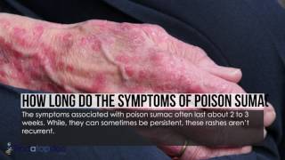 What Is Poison Sumac [upl. by Rhtaeh]