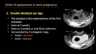 Ultrasound of normal early pregnancy [upl. by Philander]