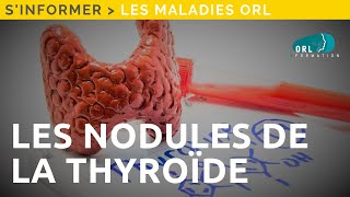 Information Patient  Les nodules de la thyroïde [upl. by Jillian114]