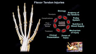 Flexor Tendon Injuries  Everything You Need To Know  Dr Nabil Ebraheim [upl. by Theta]