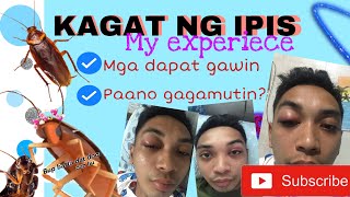 KAGAT NG IPIS  MY EXPERIENCE [upl. by Ultan]